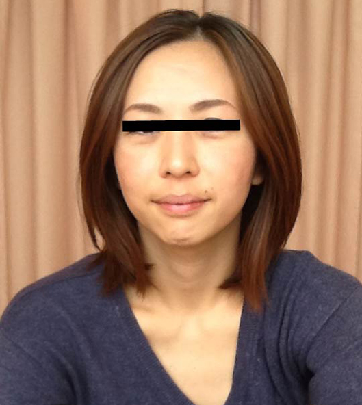 before画像