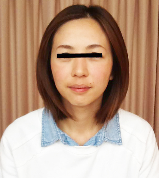 before画像