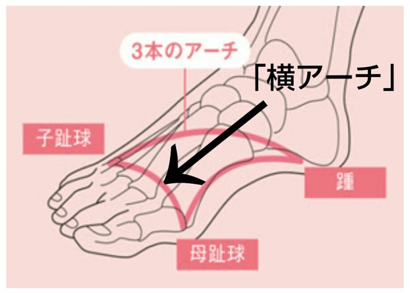 足底筋膜炎
